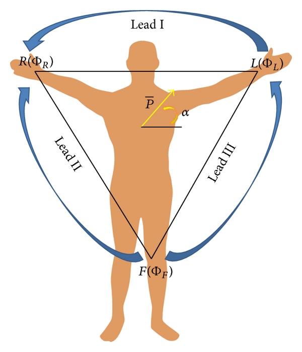 (b) Limb leads and electrodes