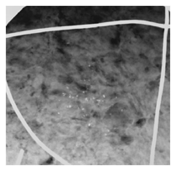 (d) Spot film of quadrant IV using the indirect CCD technique with a 512 acquisition matrix