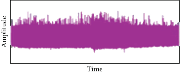 (h) Denoised signal of NDWT for 35 of age male