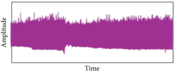 (j) Denoised signal of NDWT for 38 of age male
